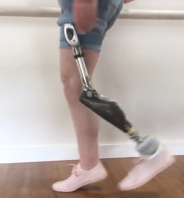 Trialling the bionic leg for the first time 01-19
